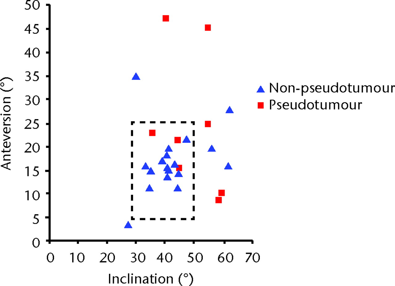 Fig. 5 
            Scatter graph showing the angles of
inclination and anteversion of the acetabular component for the
pseudotumour group (9 hips in 6 patients) and the non-pseudotumour
group (21 hips in 13 patients). Lewinnek’s safe zone29 is outlined by
the dotted rectangle.
          