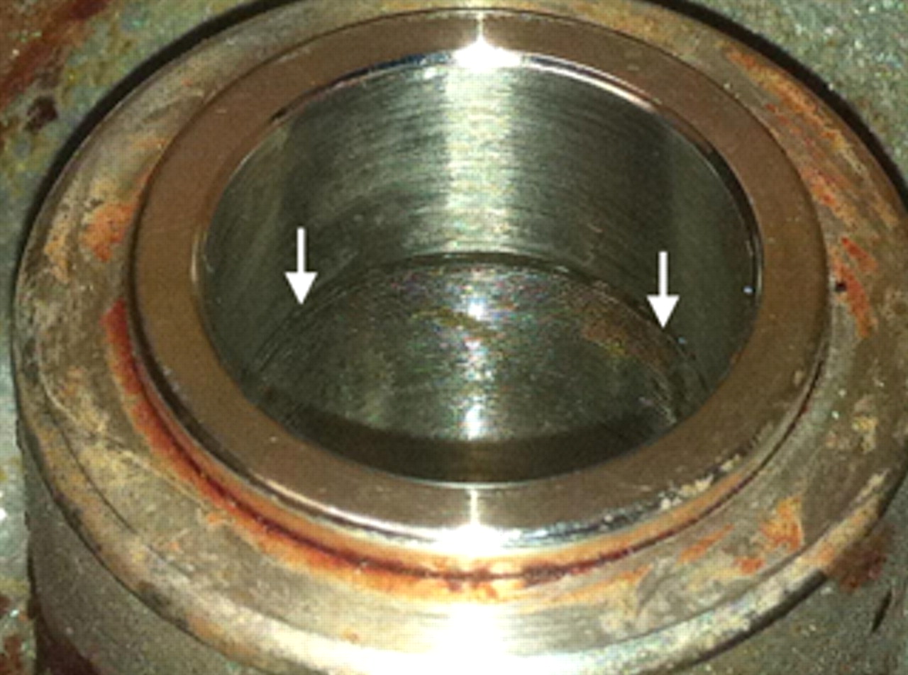 Fig. 1 
            Photograph of an Articular Surface Replacement
(ASR) XL head with Corail taper adaptor. The arrows represent the
taper engagement level.
          