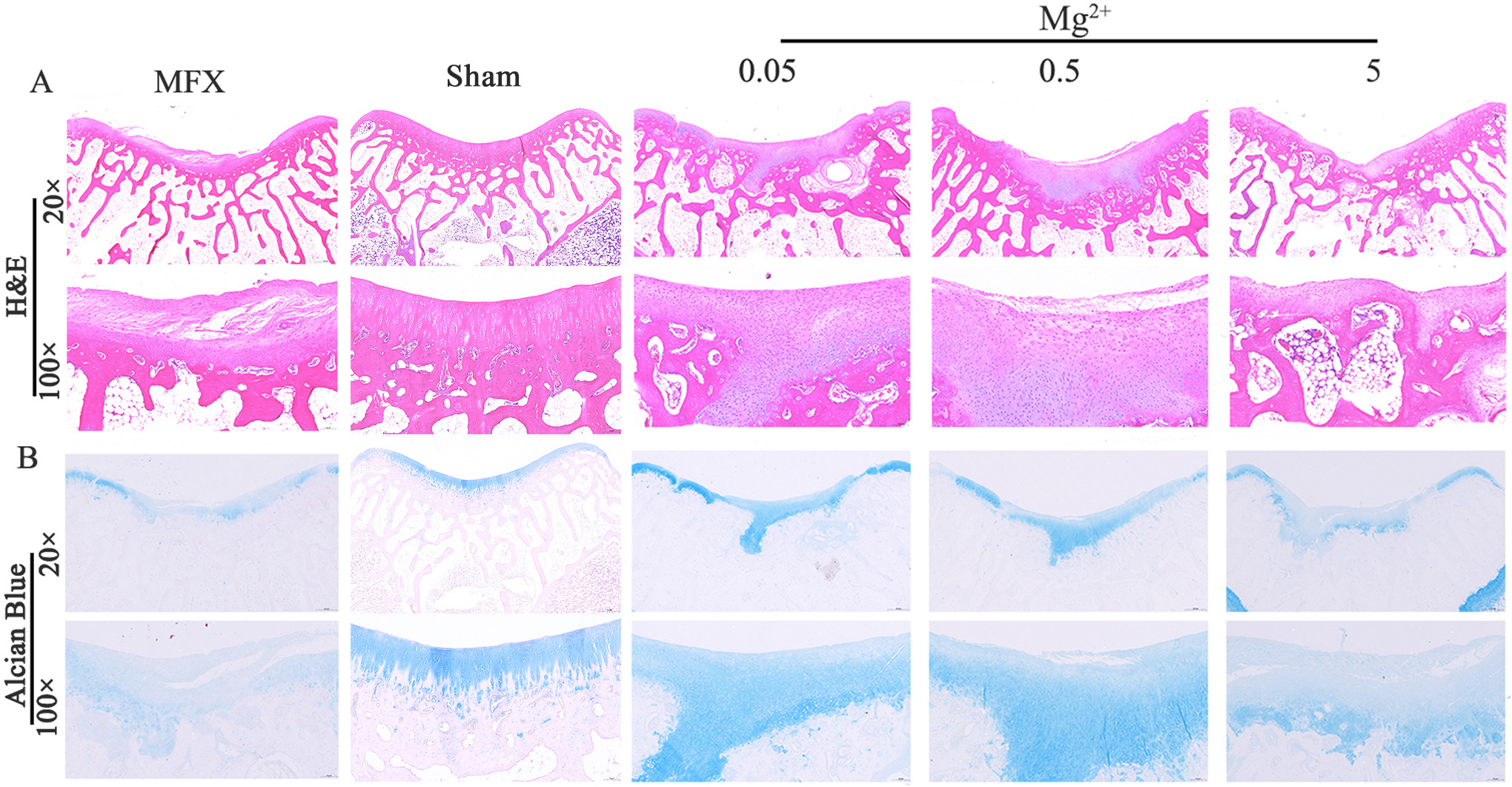 Fig. 2 
          Haematoxylin and eosin (H&E) staining and Alcian Blue staining at six weeks after microfracture (MFX). a) H&E staining. b) Alcian Blue staining. Scale bar = 500 µm (20×); scale bar = 100 µm (100×); n = 6 rabbits per group.
        