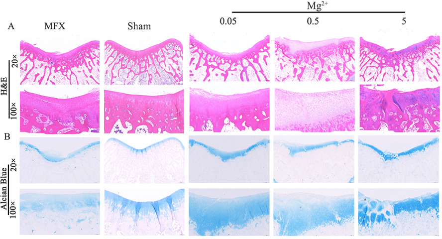 Fig. 6 
          Haematoxylin and eosin (H&E) staining and Alcian Blue staining at 12 weeks after microfracture (MFX). a) H&E staining; b) Alcian Blue staining; scale bar = 500 µm (20×). Scale bar = 100 µm (100×); n = 6. Each staining photograph represents the results of one rabbit from each group.
        