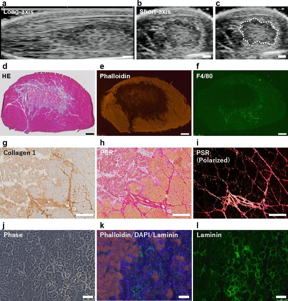 Fig. 2 
            Ultrasound images and histological sections of tibialis anterior 24 hours after cardiotoxin (CTX) injection. a) Long-axis and b) short-axis ultrasound images. c) In a short-axis ultrasound image, lesion containing more hypoechoic area than normal muscle tissue is outlined with a dotted line. d) to i) Histological analysis performed using the cross-sectional sections. Staining with haematoxylin and eosin (HE), phalloidin, and anti-F4/80 antibody is shown. g) to l) Stained images of the area bordering CTX-induced muscle injury and surrounding tissue. Myofibres, endomysium, and perimysium at the site of muscle injury were stained with anti-collagen 1 antibody, Picrosirius red (PSR) without/with polarized microscopy, anti-laminin antibody, phalloidin, and 4′,6-diamidino-2-phenylindole (DAPI). In the merged image, myofibres were labelled with phalloidin (red), nuclei with DAPI (blue), and endomysium with laminin (green). Scale bars = 1 mm in a) to f), 500 μm in g) to i), and 100 μm in j) to l).
          