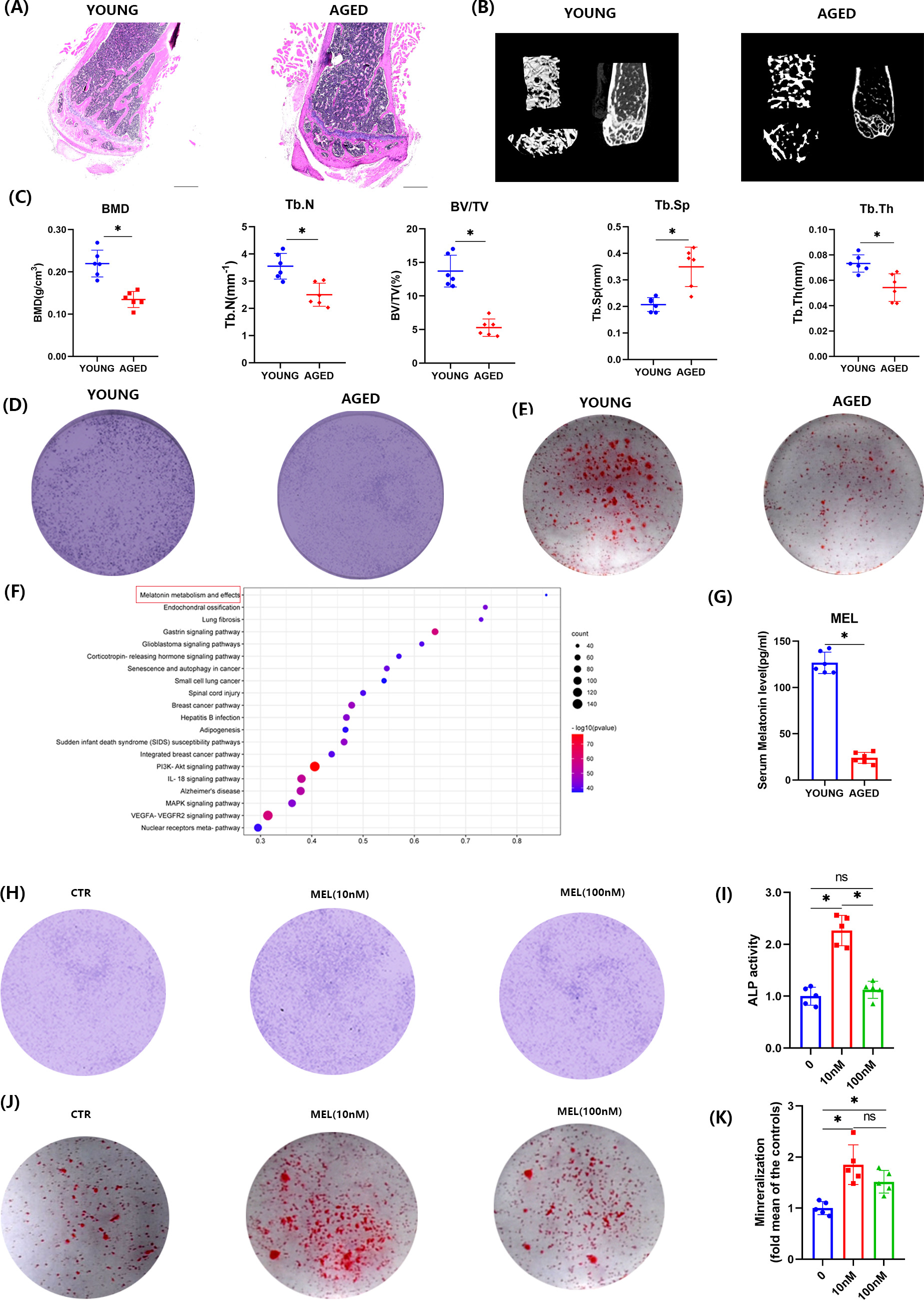 Fig. 1 
            Aged bone marrow-derived mesenchymal stem cells (BMMSCs) showed degenerative properties in osteogenesis and melatonin (MEL) promoted osteogenesis of aged BMMSCs. a) Haematoxylin and eosin (H&E) staining (40×) of proximal tibiae and b) micro-CT (μCT) imaging of distal femora of aged and young mice. c) Bone microstructure parameters such as bone mineral density (BMD), trabecular bone volume per total volume (BV/TV), trabecular bone thickness (Tb.Th), trabecular bone number (Tb.N), and trabecular bone separation (Tb.Sp). An independent-samples t-test was used to calculate the p-value in Figure 1c. d) Alkaline phosphatase (ALP) staining (20×) and e) Alizarin Red staining (20×) to analyze the osteogenesis of young and aged BMMSCs. f) Gene enrichment analysis of genes related to senile osteoporosis predicted using the Genecard database, DisGeNET database, and OMIM database, highlighting pathways where MEL metabolism and effects showed the highest enrichment in WikiPathways. Chi-squared test was used to calculate the p-value. g) MEL in serum was analyzed by enzyme-linked immunosorbent assay (ELISA). h) ALP staining (5×), i) ALP level analysis, j) Alizarin Red staining (5×), and k) mineralization level analysis were performed. *p < 0.05, significant differences between each indicated group analyzed using one-way analysis of variance (ANOVA). CTR, control group; IL-18, interleukin-18; MAPK, mitogen-activated protein kinase; ns, not significant; PI3K-AKT, phosphoinositide 3-kinase-protein kinase B; VEGFA-VEGFR2, vascular endothelial growth factor-vascular endothelial growth factor receptor 2.
          