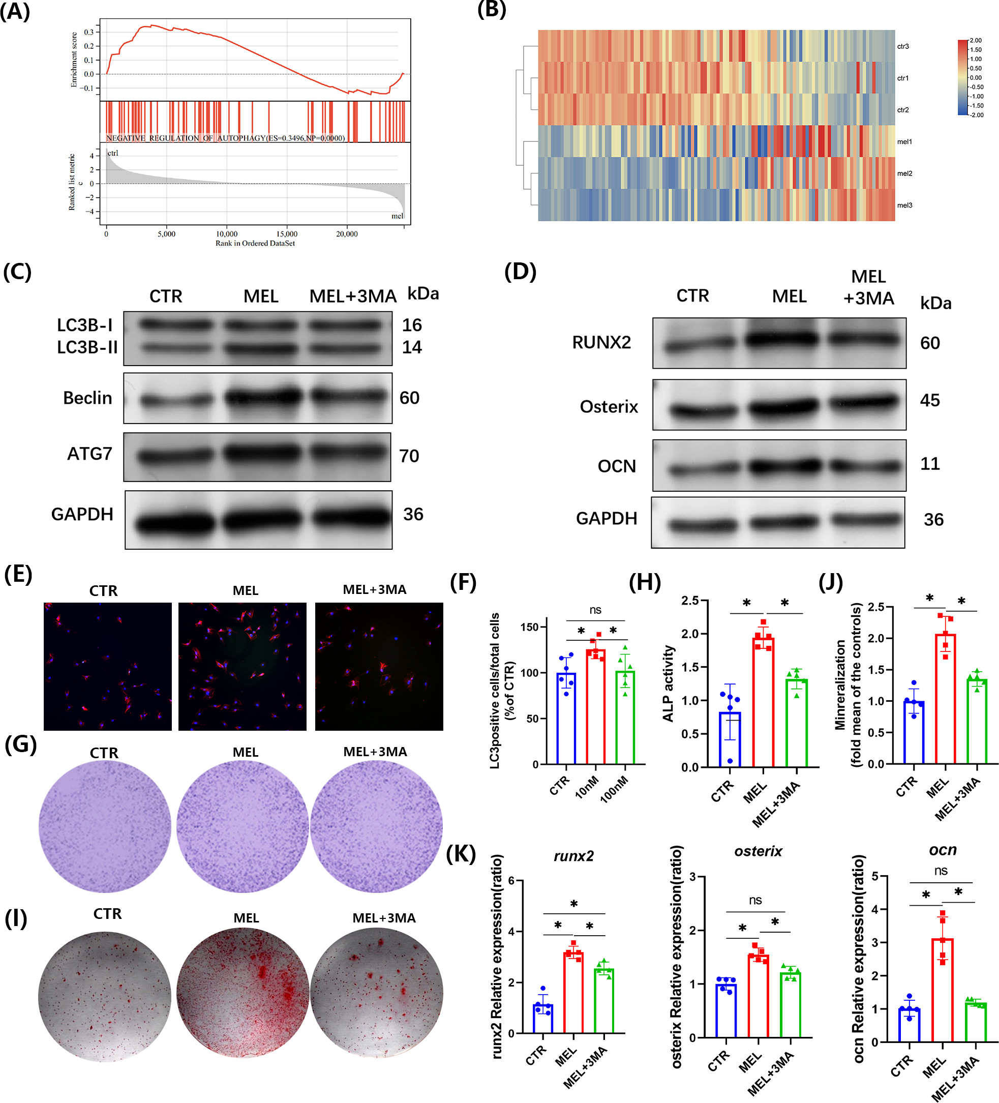 Fig. 2 
            Melatonin (MEL) induced osteogenic promotion by regulating autophagy in aged bone marrow-derived mesenchymal stem cells (BMMSCs). a) Gene set enrichment analysis (GSEA) results of negative regulation of autophagy pathway. b) Heatmaps of gene expression included in the aforementioned biological process. One-way analysis of variance (ANOVA) was used to calculate the p-value. c) Protein presentations of autophagic markers LC3B, Beclin1, and ATG7 in aged BMMSCs treated with MEL of different concentrations. d) Protein presentations of osteogenesis markers RUNX2, Osterix, and osteocalcin (OCN). e) and f) Immunofluorescence staining of LC3B (400×) and quantitative analysis of positive cells in aged BMMSCs. g) and h) Alkaline phosphatase (ALP) levels (20×) after osteogenic induction for seven days. i) and j) Mineralization levels (20×) were detected by Alizarin Red staining after 21 days of osteogenic induction. One-way ANOVA was used to calculate the p-value. k) Gene levels of osteogenesis markers osterix, runx2, and ocn in aged BMMSCs. Data are expressed as the mean and SD, n = 5 in each group. *p < 0.05, significant differences between each indicated group analyzed using one-way ANOVA or an independent-samples t-test. CTR, control group; ES, enrichment score; GAPDH, glyceraldehyde-3-phosphate dehydrogenase; NP, normalized p-value; ns, not significant.
          