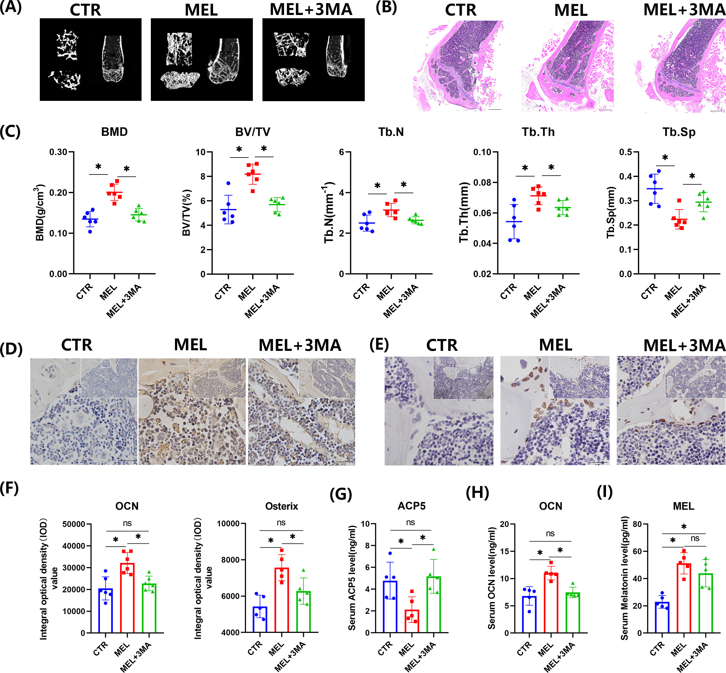 Fig. 3 
            Inhibition of autophagy could counteract melatonin (MEL)-induced osteogenic promotion in aged mice. a) Micro-CT (μCT) imaging of distal femora and b) haematoxylin and eosin (H&E) staining (40×) of proximal tibiae of aged mice treated with MEL for six weeks (50 mg kg-1 body weight per day). c) Bone microstructure parameters such as bone mineral density (BMD), trabecular bone volume per total volume (BV/TV), trabecular bone thickness (Tb.Th), trabecular bone number (Tb.N), and trabecular bone separation (Tb.Sp) were measured by μCT scanning. d) to f) Immunohistopathology (200×) showed the osteogenic-related protein presentations of d) matricellular molecular osteocalcin (OCN) and e) osteogenic marker Osterix in proximal tibia bone tissue, and f) integral optical density (IOD) was calculated. g) to i) Concentrations of g) bone resorption marker ACP5, h) osteogenic marker OCN, and i) MEL in serum were analyzed by enzyme-linked immunosorbent assay (ELISA). *p < 0.05, significant differences between each indicated group analyzed using Fisher’s exact test, one-way analysis of variance (ANOVA), or Tukey’s post-hoc test. CTR, control group; ns, not significant.
          