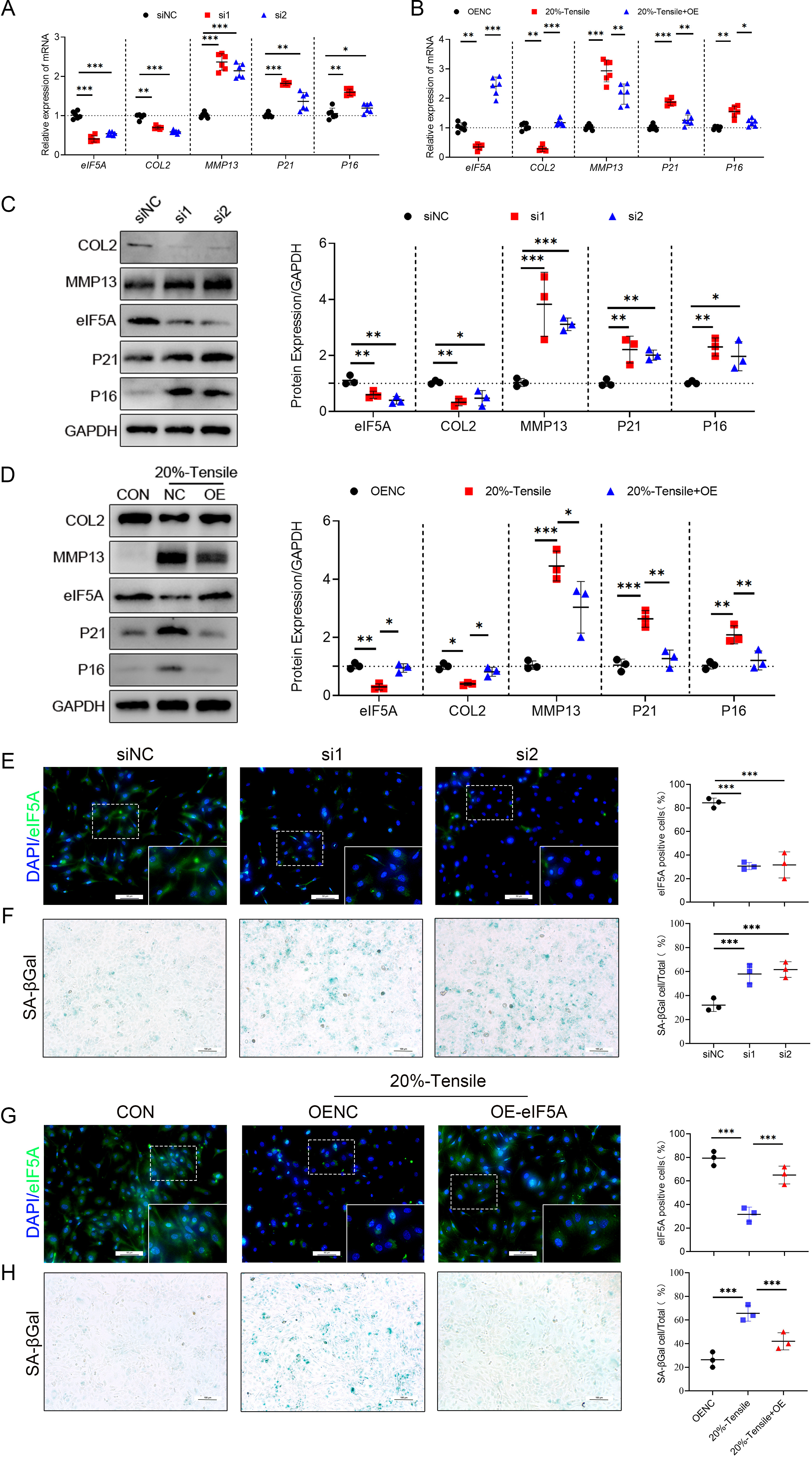 Fig. 2 
            Knockdown/overexpression of eukaryotic translation initiation factor 5A (eIF5A) can aggravate or rescue the injury of chondrocytes in osteoarthritis (OA). a) Quantitative polymerase chain reaction (qPCR) analysis of eIF5A, type II collagen (COL2), martrix metalloproteinase 13 (MMP13), P21, and P16 in primary chondrocytes transfected with si-eIF5A; n = 6 per group. b) qPCR analysis of eIF5A, COL2, MMP13, P21, and P16 in mouse primary chondrocytes treated with or without OE-eIF5A under 20% cyclic tensile strain; n = 6 per group. c) Western blot (WB) analysis and quantification of eIF5A, COL2, MMP13, P21, and P16 in si-eIF5A-transfected primary chondrocytes; n = 3 per group. d) WB analysis and quantification of eIF5A, COL2, MMP13, P21, and P16 in mouse primary chondrocytes treated with or without OE-eIF5A at 20% cyclic tensile strain; n = 3 per group. e) and f) Immunofluorescence (IF) and senescence-associated β-galactosidase (SA-βGal) staining of eIF5A after transfection of primary chondrocytes with si-eIF5A and corresponding quantitative plots; n = 3 per group. g) and h) IF and SA-βGal staining of primary mouse chondrocytes treated with or without OE-eIF5A at 20% cyclic tensile strain and corresponding quantification plots; n = 3 per group. An independent-samples t-test and one-way analysis of variance were used for statistical analyses (*p < 0.05, **p < 0.01, ***p < 0.001). CON, control; GAPDH, glyceraldehyde-3-phosphate dehydrogenase; NC, negative control; ns, not significant; OE, over-expression.
          