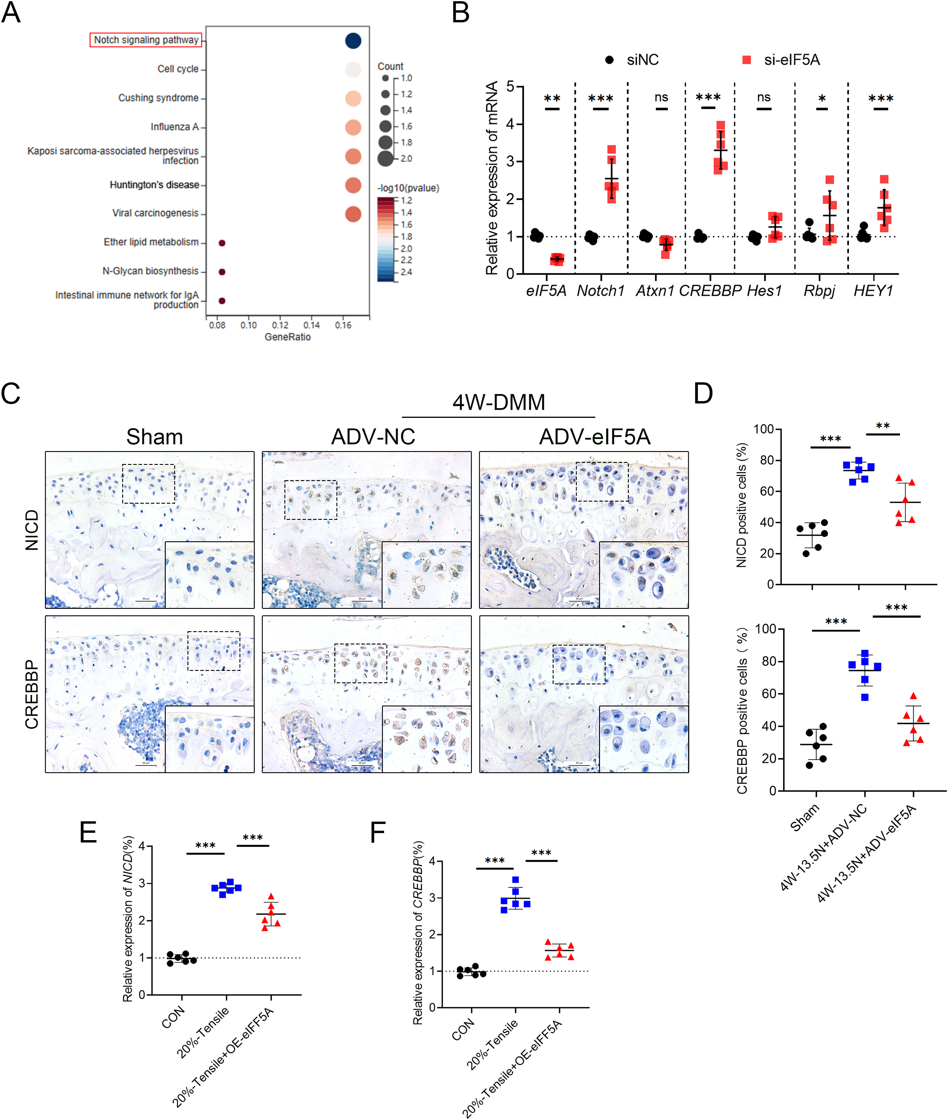 Fig. 5 
            Notch pathway activation was most pronounced as eukaryotic translation initiation factor 5A (eIF5A) was downregulated. a) Kyoto Encyclopedia of Genes and Genomes (KEGG) pathway enrichment analysis of differential genes in chondrocytes after si-eIF5A. b) Quantitative polymerase chain reaction (qPCR) analysis of key molecules of the Notch pathway in chondrocytes after si-eIF5A; n = 6 per group. c) and d) Immunohistochemistry (IHC) staining of Notch intracellular domain (NICD) and cyclic-AMP response element binding protein (CREB)-binding protein (CREBBP) in knee cartilage of control, destabilization of the medial meniscus (DMM), and post-DMM eIF5A adenovirus-injected mice, and quantification of positive particles; n = 6 per group. e) and f) qPCR analysis of NICD and CREBBP in primary mouse chondrocytes treated with or without OE-eIF5A under 20% cyclic tensile strain; n = 6 per group. An independent-samples t-test and one-way analysis of variance were used for statistical analyses (*p < 0.05, **p < 0.01, ***p < 0.001). CON, control; IgA, immunoglobulin A; ns, not significant.
          