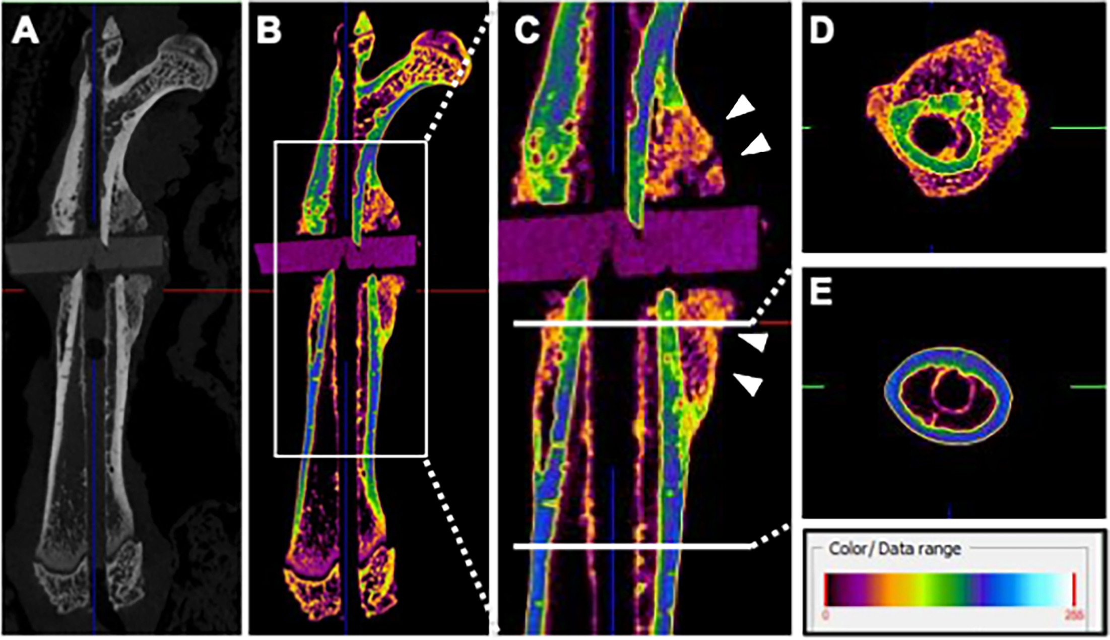 Fig. 2 
            Micro-CT (μCT) images of the femur three weeks after the first operation (the intramedullary Kirschner wire was removed to avoid metal artefact effects). a) μCT image of the whole femur (grayscale image). b) μCT image of the whole femur (pseudo-colour image). c) Callus formation around the fracture site (indicated by white arrows). d) Pseudo-colour image of the cortical bone at the fracture ends, based on Hounsfield unit (HU), showing the low HU value of cortical bone and callus formation in the surrounding tissue. e) Pseudo-colour image of the normal cortical bone.
          