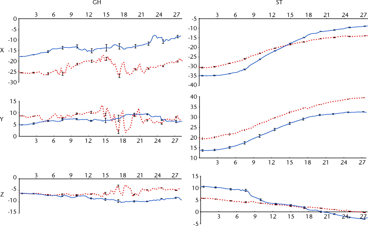 Fig. 4 
            Graphs showing the glenohumeral (GH)
translation (in mm) and scapulothoracic (ST) rotations (in °) for
the right and left shoulder (red and blue, respectively) in the cadaveric
shoulder model, versus time (in seconds). The GH
translation is reported in the scapular reference system and ST
rotation is reported in the thoracic reference system. Error bars
showing the standard deviation are also reported for instants of
time.
          