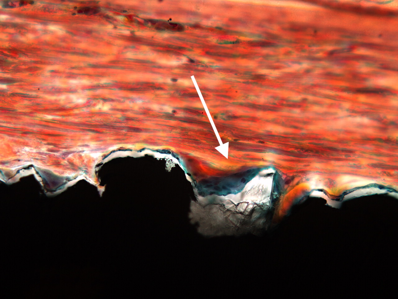 Figs. 2a - 2b 
          Two light micrograph images (primary
magnification 40, different light filters) of bone formation seen
as a thin green line along the implant surface (arrows), which is
coated with Bonemaster.
        