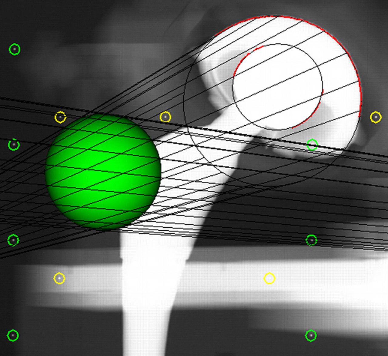 Figs. 3a - 3c 
            Graphic outputs for the assessment
of polyethylene wear, a) using model-based radiostereometric analysis
(MB-RSA), showing the scanned model of the acetabular component
(in green), b) geometrical sphere model RSA (EGS-RSA), showing the
regions of interest (in which the models are matched with mathematical
algorithms) marked with red lines on the peripheries of the acetabular
component and femoral head, and c) the PolyWare software, showing
ellipses fitted to the peripheries of the acetabular component and
femoral head shadows.
          