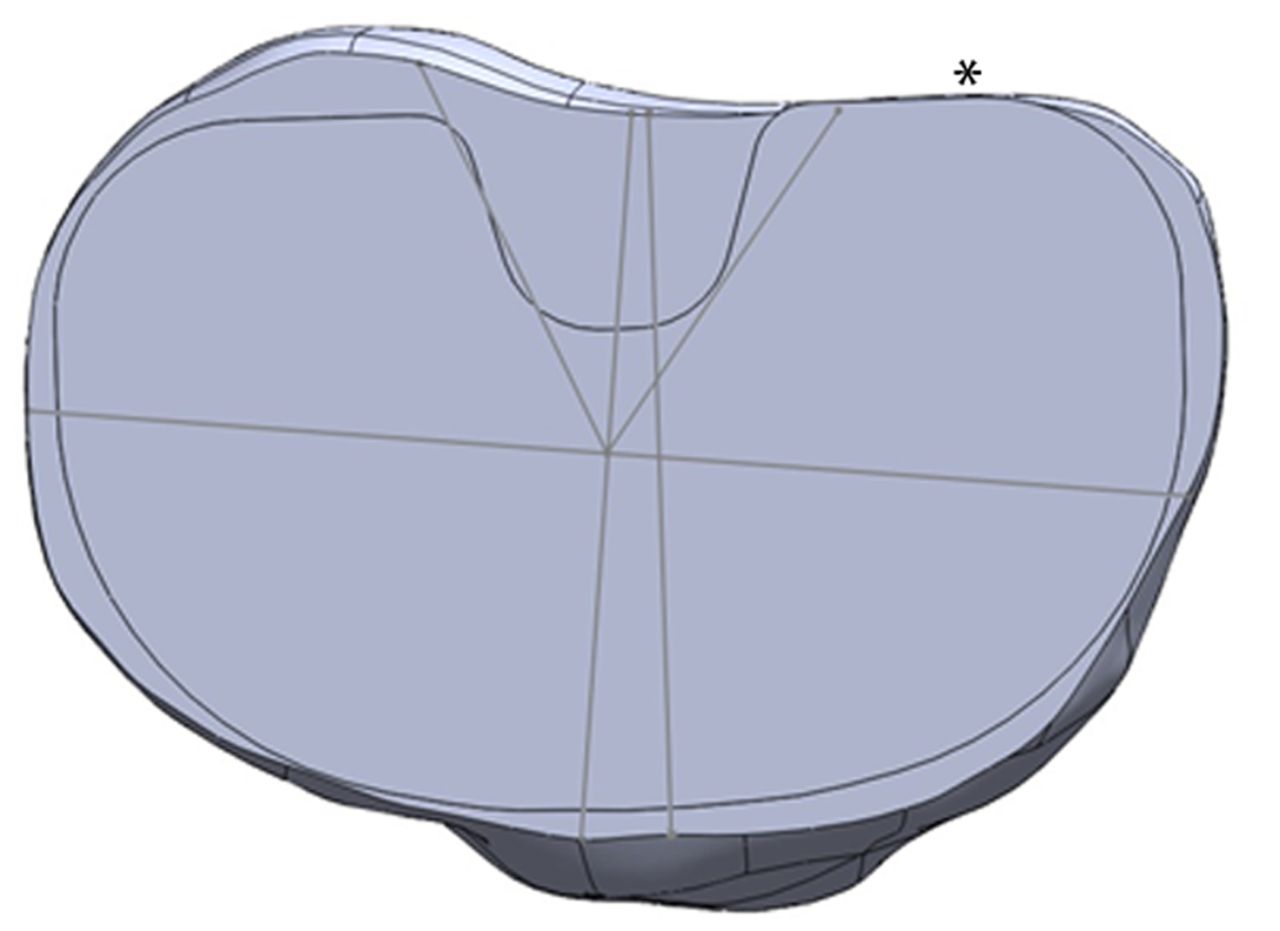 Figs. 4a - 4b 
            Diagrams showing the tibia template,
with a) the asymmetric prosthesis aligned with the surgical axis,
with no overhang permitted, and b) the symmetric prosthesis aligned
with the surgical axis, with minimal posterolateral overhang permitted
(*).
          