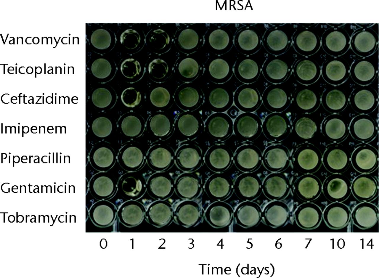 Figs. 1a - 1c 
          Micro-tube dilution bioassays
showing the antibacterial activities against gram-positive bacteria
in broth elution samples from the low-dose antibiotic loaded cements
(1 g antibiotic in 40 g polymethylmethacrylate) over a 14-day elution
period for a) methicillin-sensitive Staphylococcus aureus (MSSA),
b) methicillin-resistant Staph. aureus (MRSA) and
c) coagulase-negative staphylococci (CoNS).
        