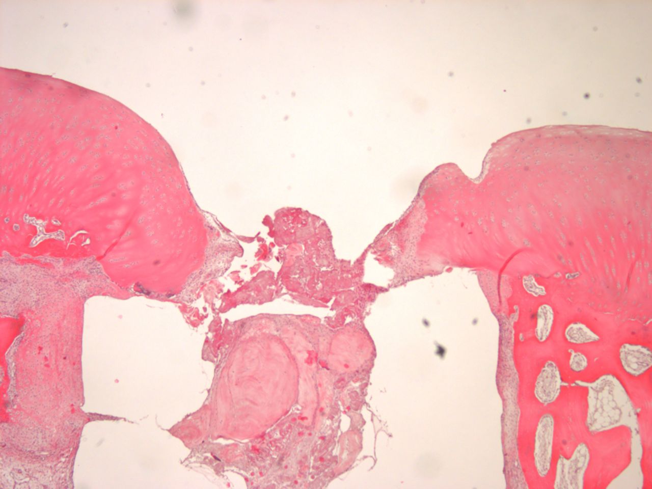 Figs. 4a - 4b 
            Histological images of cartilage
after removal of the SonicPin system (Stryker GmbH), a) at × 25
magnification, showing the cartilage surface without major damage
after removing the SonicPin, and b) at × 40 magnification, showing
the cartilage next to the removed SonicPin.
          