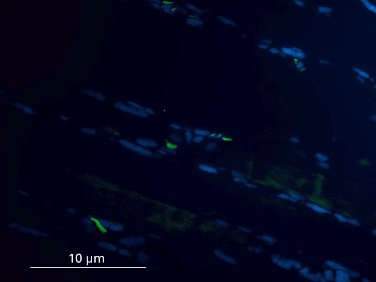 Figs. 1a - 1d 
            Histological images
showing the identification of muscle satellite cells by immunofluorescence.
Satellite cells are marked with Pax7 antibody (green) and myonuclei
with DAPI (blue). In cases where the final image confirmed the presence
of a Pax7 positive cell and DAPI, but location under the sarcolemma
was in question, care was taken to examine the muscle architecture,
and cells superficial to the basal lamina were not counted.
          