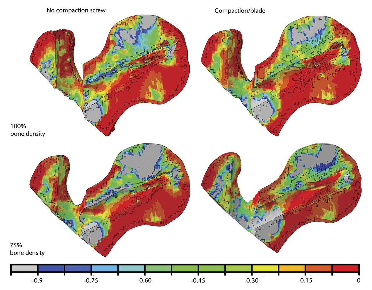 Fig. 2 
          Diagrams showing the minimum (compressive)
principal strains plotted in percent with a yield strain cut-off value
of -0.9%. Grey regions have strains below -0.9% and are at higher
risk of being involved in blade cut-out.
        