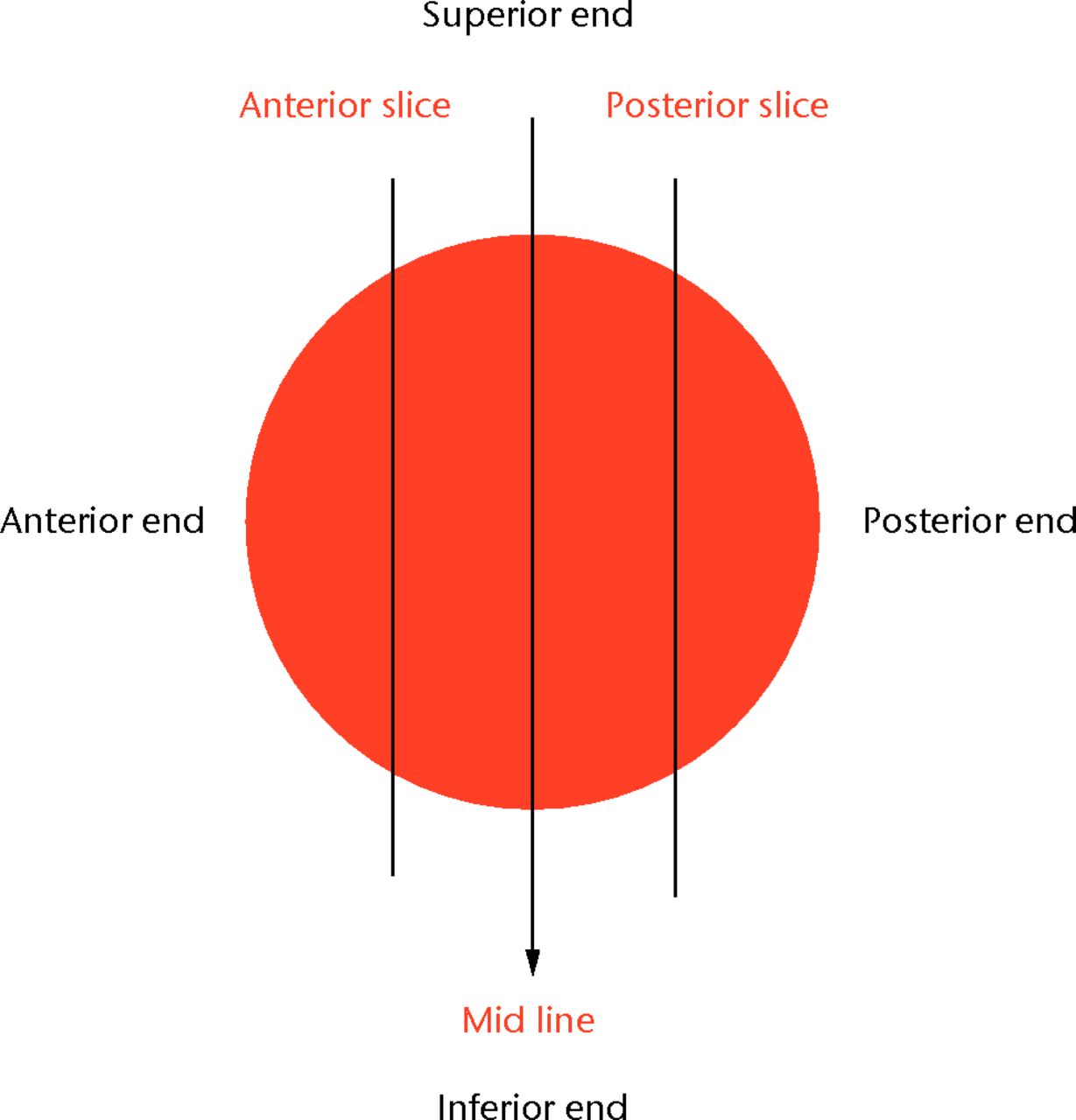 Fig. 1 
            Cutting diagram showing the coronal
sections of the femoral head.
          