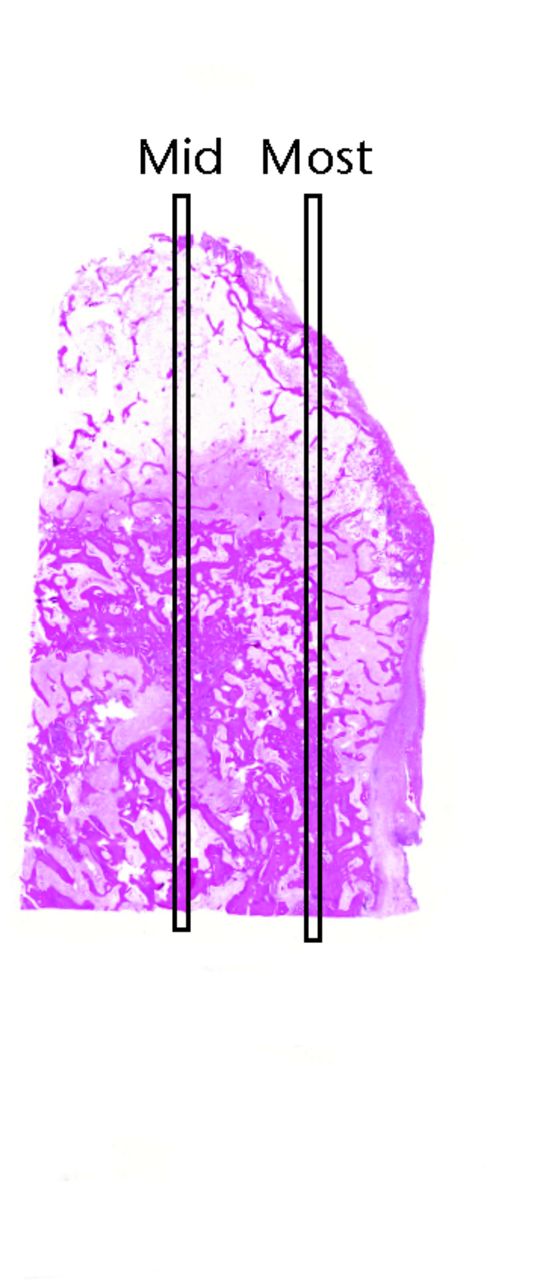 Fig. 2 
            Sample slide showing where the ‘mid’
and ‘most’ strips are marked for counting.
          