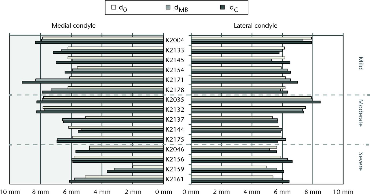 Fig. 2 
          Barplots of the estimated insert thicknesses
dC from the conventional mJSW method, dMB from
the model-based mJSW method, and actual minimum insert thickness
d0 for each case. The cases are ordered as in Table I
and grouped by wear grade.
        