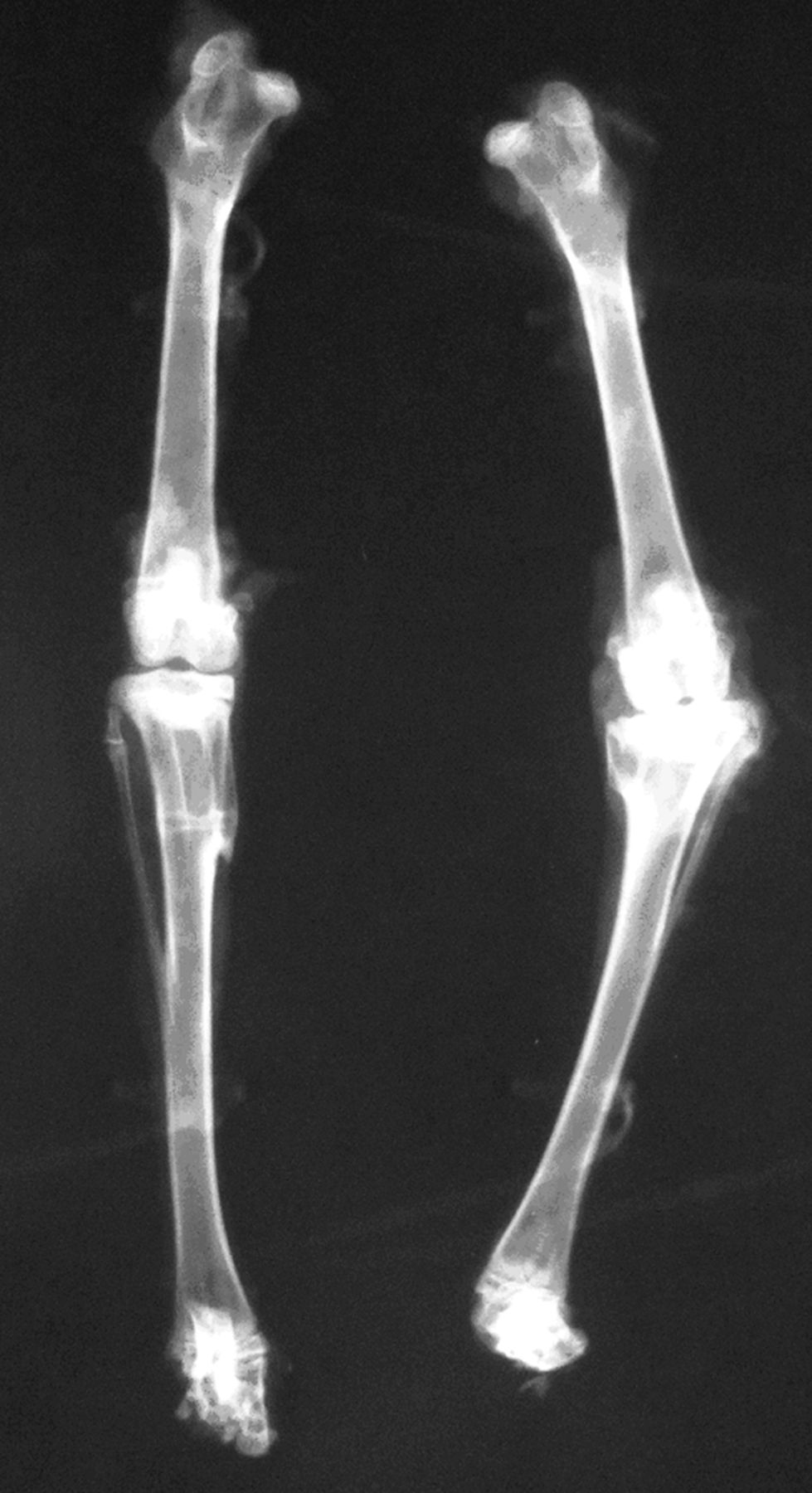 Fig. 3 
            Radiograph showing the right tibia after
autologous cultured growth chondrocytes with no angular deformity,
and the left tibia after partial resection of the plate growth without
grafting varus deformity. 
          