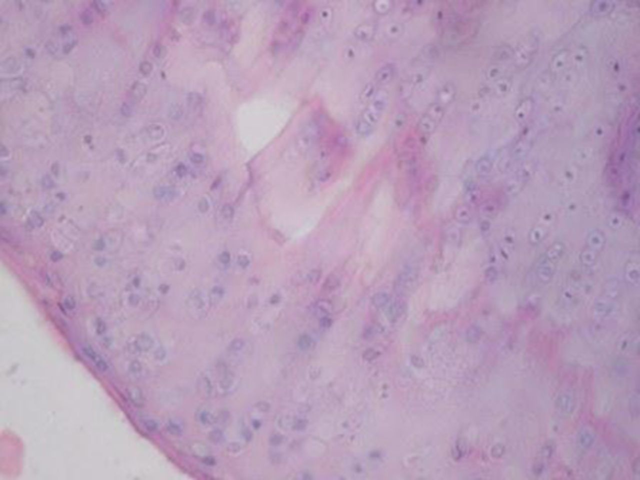 Figs. 2a - 2d 
            
              Figures 2a and 2b – histological
images of articular cartilage in the mesenchymal stem cell (MSC)-treated
group a) at 16 weeks and b) at 20 weeks post-operatively, showing
appropriate thickness, normal distribution of the cells and consistent
staining of the cartilage, with the surface layer showing very mild
irregularity (haematoxylin and eosin, ×40). Figures 2c and 2d –
histological images of articular cartilage in the control group
c) at 16 weeks and d) at 20 weeks post-operatively, showing structural
disorganisation and severe hypocellularity of chondrocytes.
          