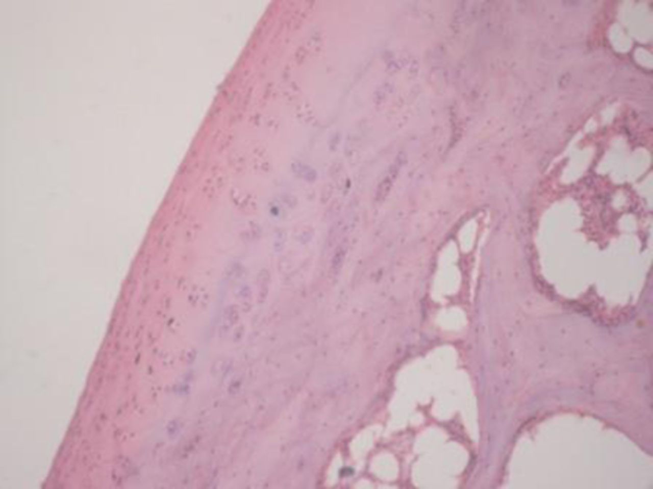 Figs. 2a - 2d 
            
              Figures 2a and 2b – histological
images of articular cartilage in the mesenchymal stem cell (MSC)-treated
group a) at 16 weeks and b) at 20 weeks post-operatively, showing
appropriate thickness, normal distribution of the cells and consistent
staining of the cartilage, with the surface layer showing very mild
irregularity (haematoxylin and eosin, ×40). Figures 2c and 2d –
histological images of articular cartilage in the control group
c) at 16 weeks and d) at 20 weeks post-operatively, showing structural
disorganisation and severe hypocellularity of chondrocytes.
          