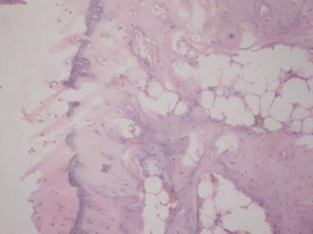 Figs. 2a - 2d 
            
              Figures 2a and 2b – histological
images of articular cartilage in the mesenchymal stem cell (MSC)-treated
group a) at 16 weeks and b) at 20 weeks post-operatively, showing
appropriate thickness, normal distribution of the cells and consistent
staining of the cartilage, with the surface layer showing very mild
irregularity (haematoxylin and eosin, ×40). Figures 2c and 2d –
histological images of articular cartilage in the control group
c) at 16 weeks and d) at 20 weeks post-operatively, showing structural
disorganisation and severe hypocellularity of chondrocytes.
          