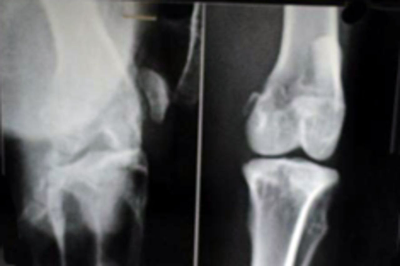 Figs. 3a - 3b 
            
              Figure 3a – anteroposterior (AP)
radiographs at 16 weeks post-operatively in the mesenchymal stem
cell (MSC)-treated group (left) and the control group (right). Figure 3b
– AP radiographs at 20 weeks post-operatively in the MSC-treated
group (left) and the control group (right). Radiological evaluation
at both time-points shows less severe radiological signs of osteoarthritis (OA)
(including osteophyte formation, subchondral bone sclerosis and
articular surface irregularity) in the MSC group compared with the
controls.
          