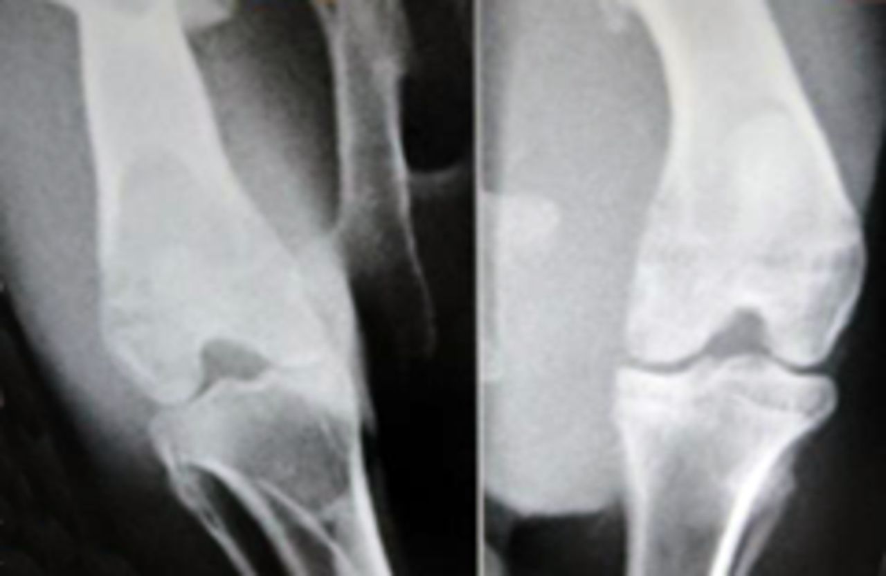 Figs. 3a - 3b 
            
              Figure 3a – anteroposterior (AP)
radiographs at 16 weeks post-operatively in the mesenchymal stem
cell (MSC)-treated group (left) and the control group (right). Figure 3b
– AP radiographs at 20 weeks post-operatively in the MSC-treated
group (left) and the control group (right). Radiological evaluation
at both time-points shows less severe radiological signs of osteoarthritis (OA)
(including osteophyte formation, subchondral bone sclerosis and
articular surface irregularity) in the MSC group compared with the
controls.
          