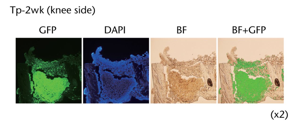 Figs. 2a - 2b 
          
            Figure 2a – Histological analyses
of the femur from a rat bone defect model. Left panel indicates
the wild-type rat as a negative control (n = 4), middle panel indicates
the GFP-Tg rat as a positive control (n = 1), and right panel indicates
the bone defect rat transplanted with osteoblast-like cells after
two weeks of transplantation (Tp-2w, n = 4). Images (x 20) are merged
with GFP field and bright field. Figure 2b – Low magnification images
of the femur from bone defect rats transplanted with osteoblast-like
cells (x2). Histological analysis of the bone defect rats was performed
after two weeks of transplantation (Tp-2w). The scaffolds contain
osteoblast-like cells were located on the defected site. The images
on the right are merged with GFP field and bright field (BF).
        