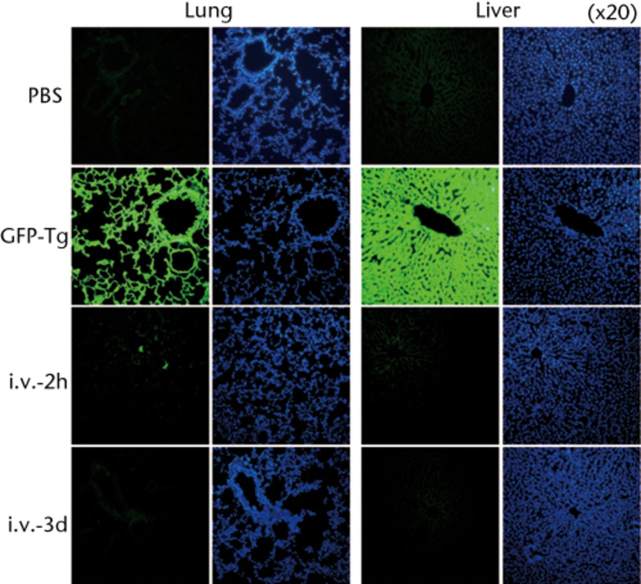 Figs. 5a - 5d 
          
            Figure 5a – Graph showing percentage
of GFP-positive cells in lung at two hours, one and three days after intravenous
infusion (n = 4 or 5 each). Values are presented as standard error
of the mean (SEM). Figure 5b – Graph showing percentage of GFP-positive
cells in BM, PB, liver, spleen and brain at two hours, one and three days
after intravenous infusion (n = 4 or 5 each). Values are presented
as standard error of the mean (SEM). Figure 5c – Representative
macroscopic images of the GFP expression in lung (left) and liver
(right) at two hours (i.v.-2h) and three days (i.v.-3d) after intravenous
infusion. PBS without osteoblast-like cells was used as a negative control,
whereas GFP-Tg rat was used as a positive control. Nuclei were stained with
DAPI. Figure 5d – Bar graph showing quantification of the GFP gene
by real-time PCR. Copy numbers of GFP were normal to that of GAPDH.
PBS was used as a negative control (NC), whereas GFP-Tg rat was
used as a positive control (PC). Values are presented as standard
error of the mean (SEM).
        