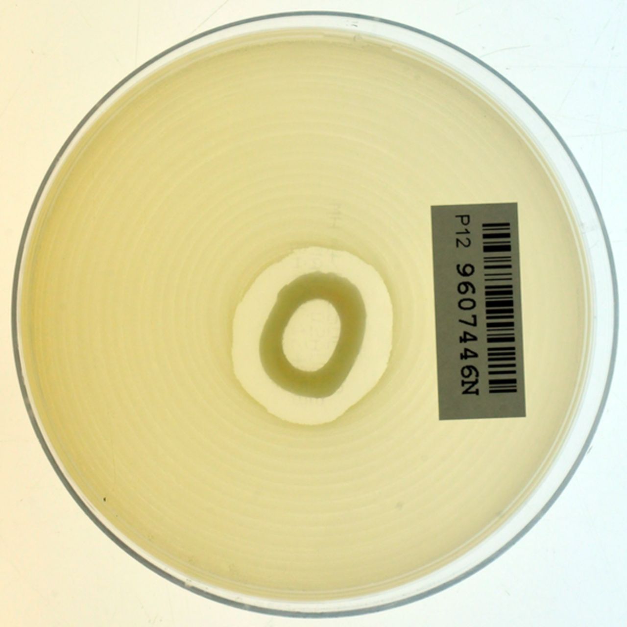 Fig. 3 
            Agar showing antibiotic activity (against
MRSA) of iontophoresed allograft.
          