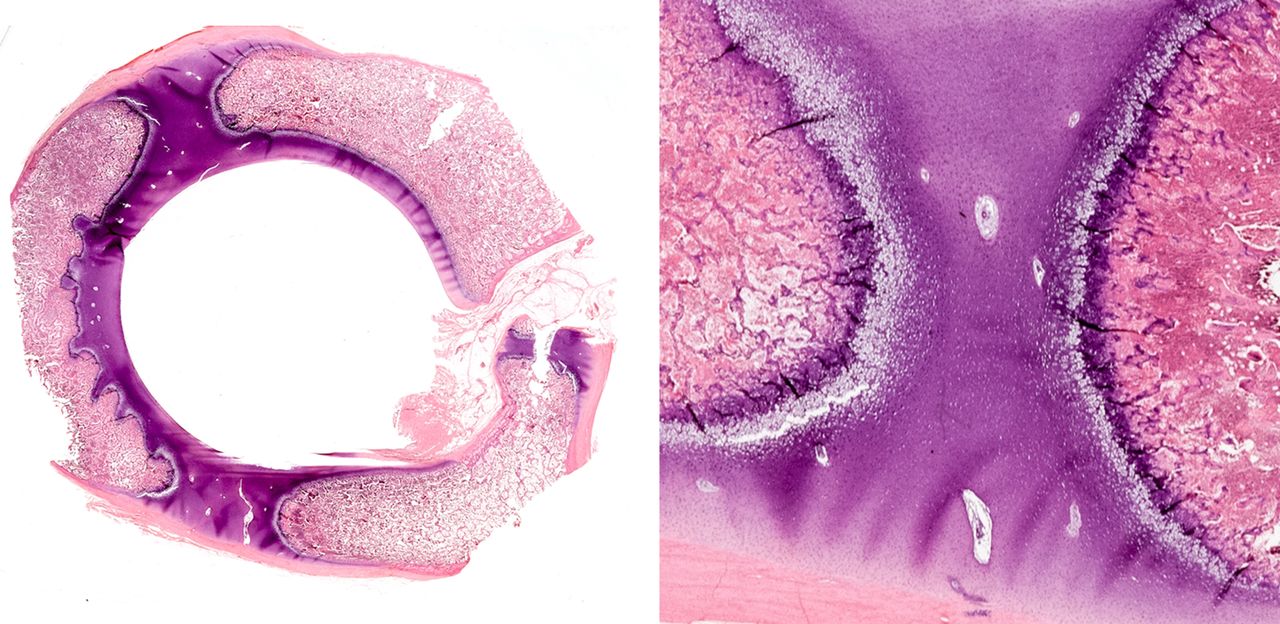 Fig. 5 
          Left: Histological cross-section of
acetabulum of non-operated side at 11 weeks of age at time of death.
Note sphericity of articular cartilage surface and well-ordered
endochondral bone development of each of ischial, iliac, and pubic
bones. At right, photomicrograph of bipolar physeal region is shown between
two adjacent bones in the normal non-operated side (hematoxylin
and eosin stain).
        