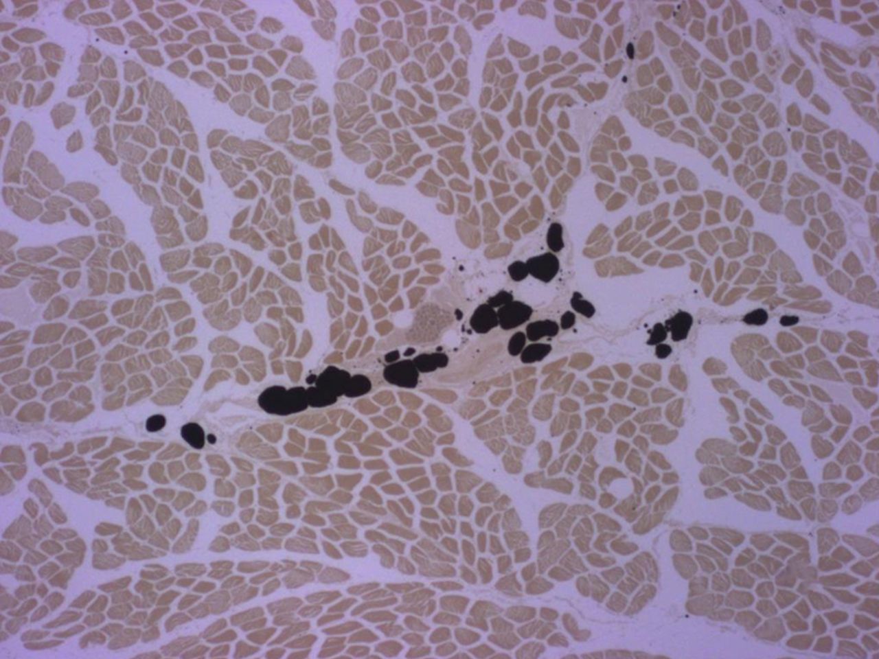 Figs. 2a - 2b 
          Micrographs of cross-sections at
the mid-part of rabbit supraspinati (SSP); the black staining represents
fat vacuoles within adipocytes called ‘intramuscular fat’ (i-fat).
a) Control specimen. b) Experimental specimen six weeks after detachment
and immediate reattachment of the SSP tendon. I-fat accumulated
between the muscle bundles. Osmium tetroxide; x 25.
        