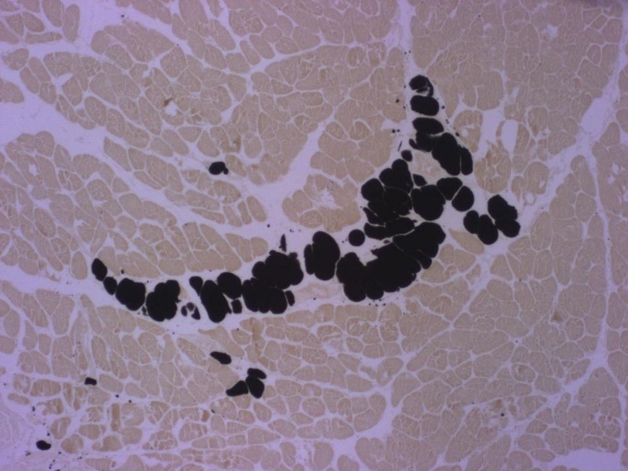 Figs. 2a - 2b 
          Micrographs of cross-sections at
the mid-part of rabbit supraspinati (SSP); the black staining represents
fat vacuoles within adipocytes called ‘intramuscular fat’ (i-fat).
a) Control specimen. b) Experimental specimen six weeks after detachment
and immediate reattachment of the SSP tendon. I-fat accumulated
between the muscle bundles. Osmium tetroxide; x 25.
        