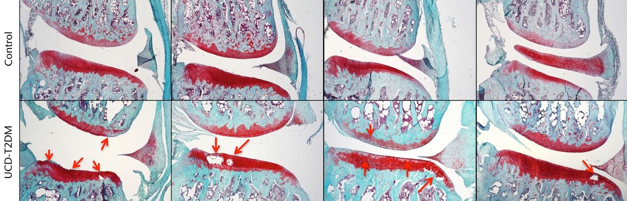 Fig. 3 
            Micrographs showing the medial aspect;
representative sections stained with Safranin-O/Fast Green, taken
at 5x magnification. Arrows indicate areas in which erosion of articular
cartilage, loss of staining, and other irregularities have occurred
in the UCD-T2DM group. On the medial side, the UCD-T2DM group showed
cysts within the cartilage and pockets of chondrocyte loss along
the tibial articular surface.
          