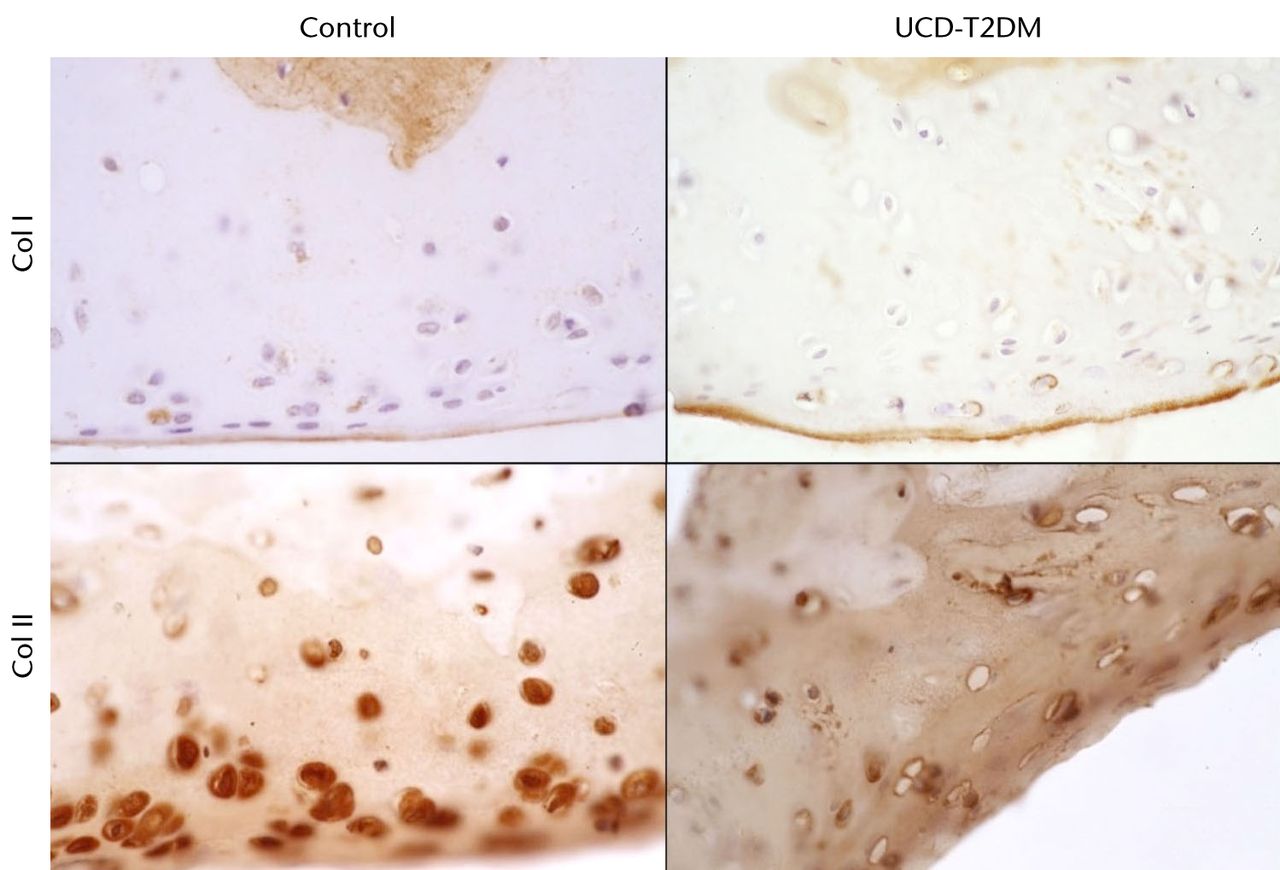 Fig. 4 
            Micrographs showing the lateral aspect;
series of representative sections stained with IHC for col I and
col II, taken at 63x magnification.
          