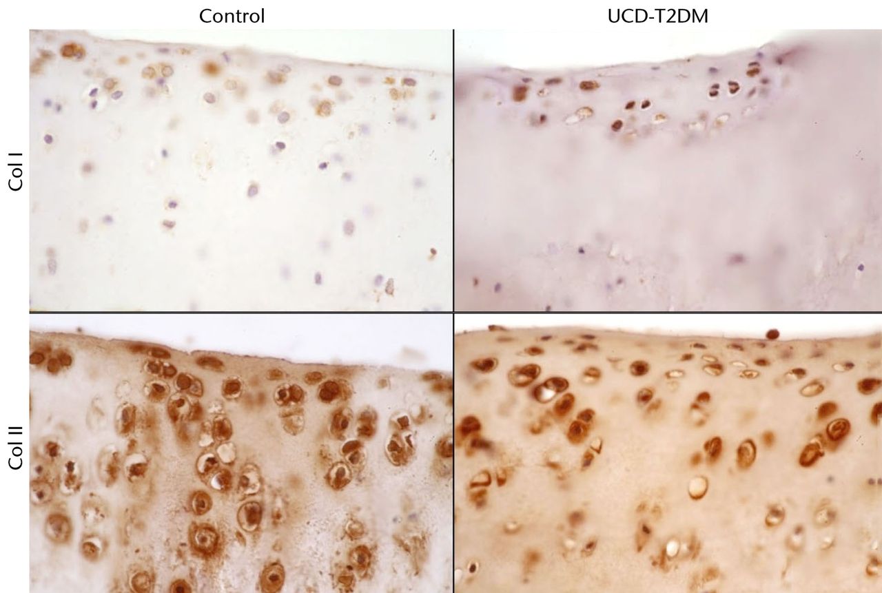 Fig. 5 
            Micrographs showing the medial aspect;
series of representative sections stained with IHC for col I and
col II, taken at 63x magnification.
          