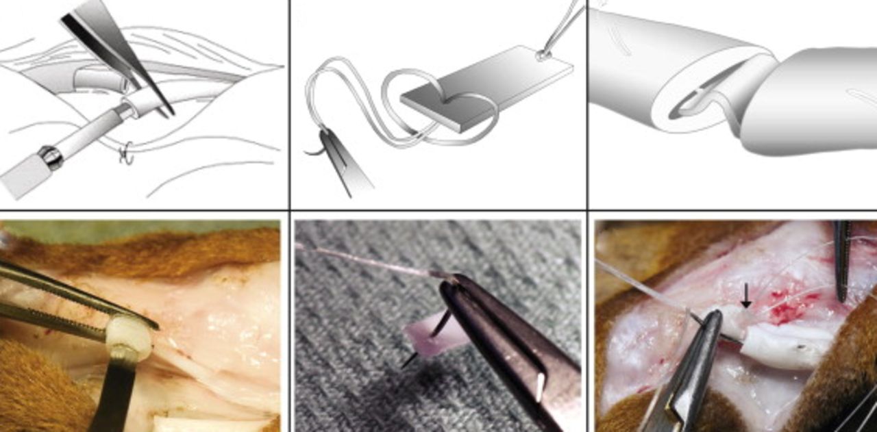 Fig. 4 
          Schematic and photographic representations
of the surgical protocol used to secure a mechanically rigid scaffold
into the core of a flexor tendon. Reprinted from Manning CN, Schwartz
AG, Liu W, et al. Controlled delivery of mesenchymal stem cells
and growth factors using a nanofiber scaffold for tendon repair.
Acta Biomater 2013;9:6905-14104 with
permission from Elsevier.
        