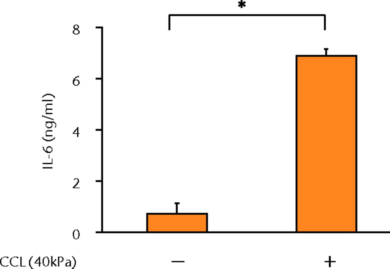 Figs. 2a - 2g 
            Graphs showing the
expressions of PGE2 and related molecules by cyclic compressive
loading. a) PGE2 was significantly upregulated by cyclic compressive
loading, interleukin- (IL-)1β, or tumour necrosis factor- (TNF)-α (n =
7). b) IL-6 (n = 6) and c) IL-8 (n = 6) were significantly upregulated
by cyclic compressive loading. d) IL-1β (n = 6) and e) TNF-α (n
= 6) were not upregulated by cyclic compressive loading. f) COX-2
(n = 6) and g) mPGES-1 (n = 5) mRNA levels were significantly upregulated
by cyclic compressive loading (CCL;cyclic compressive loading)*p
<
 0.01.
          