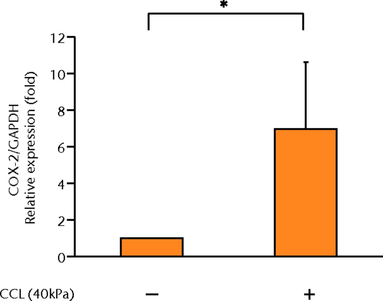 Figs. 2a - 2g 
            Graphs showing the
expressions of PGE2 and related molecules by cyclic compressive
loading. a) PGE2 was significantly upregulated by cyclic compressive
loading, interleukin- (IL-)1β, or tumour necrosis factor- (TNF)-α (n =
7). b) IL-6 (n = 6) and c) IL-8 (n = 6) were significantly upregulated
by cyclic compressive loading. d) IL-1β (n = 6) and e) TNF-α (n
= 6) were not upregulated by cyclic compressive loading. f) COX-2
(n = 6) and g) mPGES-1 (n = 5) mRNA levels were significantly upregulated
by cyclic compressive loading (CCL;cyclic compressive loading)*p
<
 0.01.
          