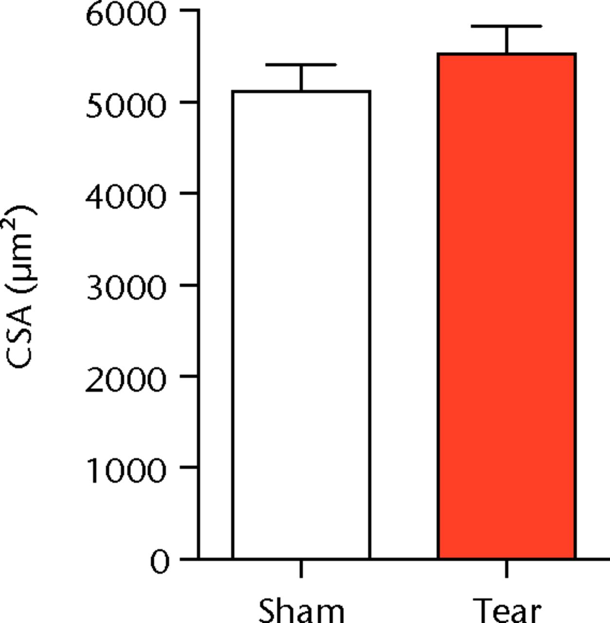 Figs. 1a - 1c 
          Graphs showing permeabilised
muscle fibre size and contractile force. Figure 1a - Permeabilised
fibre cross-sectional area (CSA); Figure 1b - maximum isometric
force (Fo) and figure 1c - specific force (sFo) of sham-operated
control and torn rotator cuff muscles. Values are mean and sem.
n = 5 muscles from each group. * different from sham-operated control
group (p <
 0.05). 
        