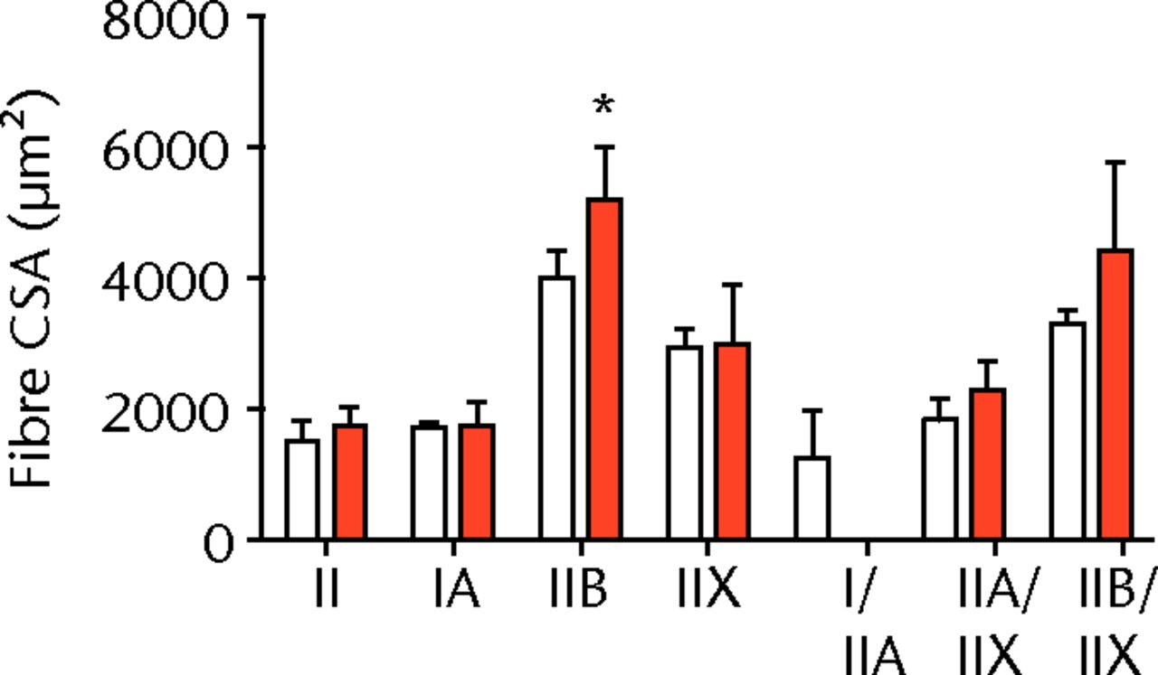 Figs. 2a - 2c 
          Muscle fibre type size and percent
composition. Figure 2a – Graphs showing cross-sectional area (CSA)
and b) percent distribution of myosin heavy chain isoform of muscle
fibres from sham-operated control and torn rotator cuff muscles.
Figure 2c - Representative immunohistochemistry demonstrating different
fibre types. White, extracellular matrix (WGA-lectin); blue, MHC I;
red, MHC IIA; green, MHC IIB; black, MHC IIX; blue-red, hybrid MHC
I/IIA; red-black, hybrid MHC IIA/IIX; green-black, hybrid MHC IIB/IIX.
Values are mean and sem. n = 5 muscles. * different from
sham-operated control group (p <
 0.05).
        