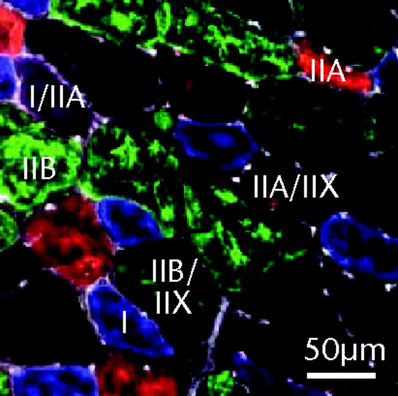 Figs. 2a - 2c 
          Muscle fibre type size and percent
composition. Figure 2a – Graphs showing cross-sectional area (CSA)
and b) percent distribution of myosin heavy chain isoform of muscle
fibres from sham-operated control and torn rotator cuff muscles.
Figure 2c - Representative immunohistochemistry demonstrating different
fibre types. White, extracellular matrix (WGA-lectin); blue, MHC I;
red, MHC IIA; green, MHC IIB; black, MHC IIX; blue-red, hybrid MHC
I/IIA; red-black, hybrid MHC IIA/IIX; green-black, hybrid MHC IIB/IIX.
Values are mean and sem. n = 5 muscles. * different from
sham-operated control group (p <
 0.05).
        