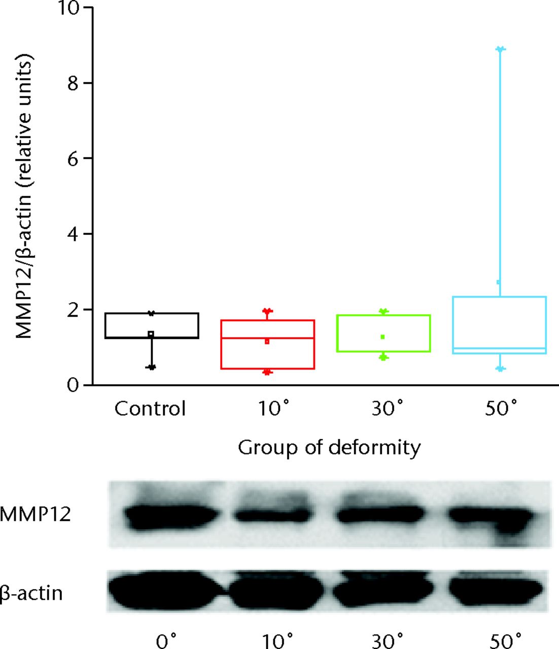 Fig. 2 
            Representative picture of Western blot
analysis for macrophage elastase (MMP12) and beta-actin from the
growth plate and intervertebral disc of the animal model tails.
The immunoreactive bands were quantified by densitometric analysis
and the ratio MMP12/beta-actin was calculated for each lane. Results are
shown as the mean ±semcompared with the controls.
          