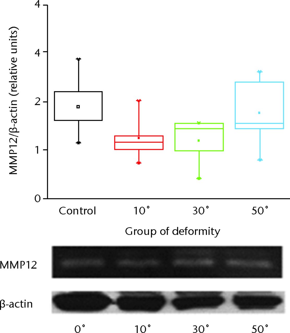 Fig. 3 
            Representative picture of zymography
analysis for MMP12. The active MMP12 bands were quantified by densitometric
analysis. Results are the mean ±sem of the ratio-active
MMP12/beta-actin compared with the controls.
          