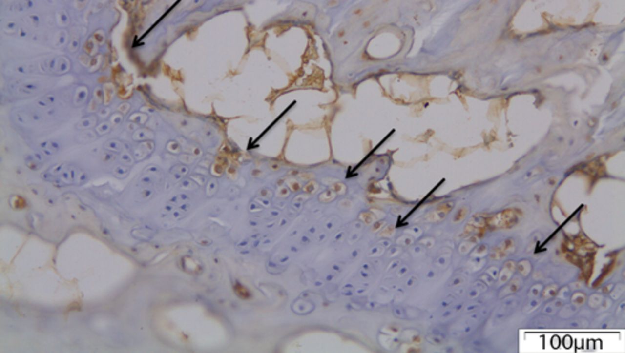 Fig. 4 
            The growth plate of a control disc with
chondrocytes expressing MMP12 (arrows).
          