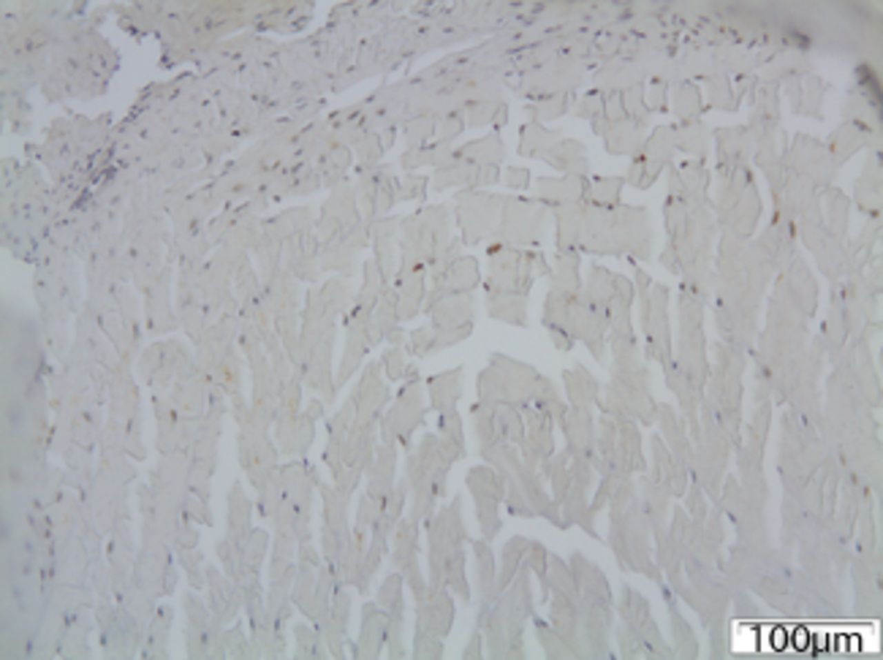 Figs. 5a - 5c 
            Immunohistochemical images of
a) the periphery of annulus fibrosus in group I with a small number
of fibroblasts expressing MMP12; b) the periphery of annulus fibrosus
in group II, where the number of disc cells expressing MMP12 is increased
and includes both fibroblasts and chondrocytes and c) the periphery
of annulus fibrosus in group III, where disc cells are absent from
the periphery of the annulus fibrosus and most of the remaining
cells from central area are expressing MMP12.
          