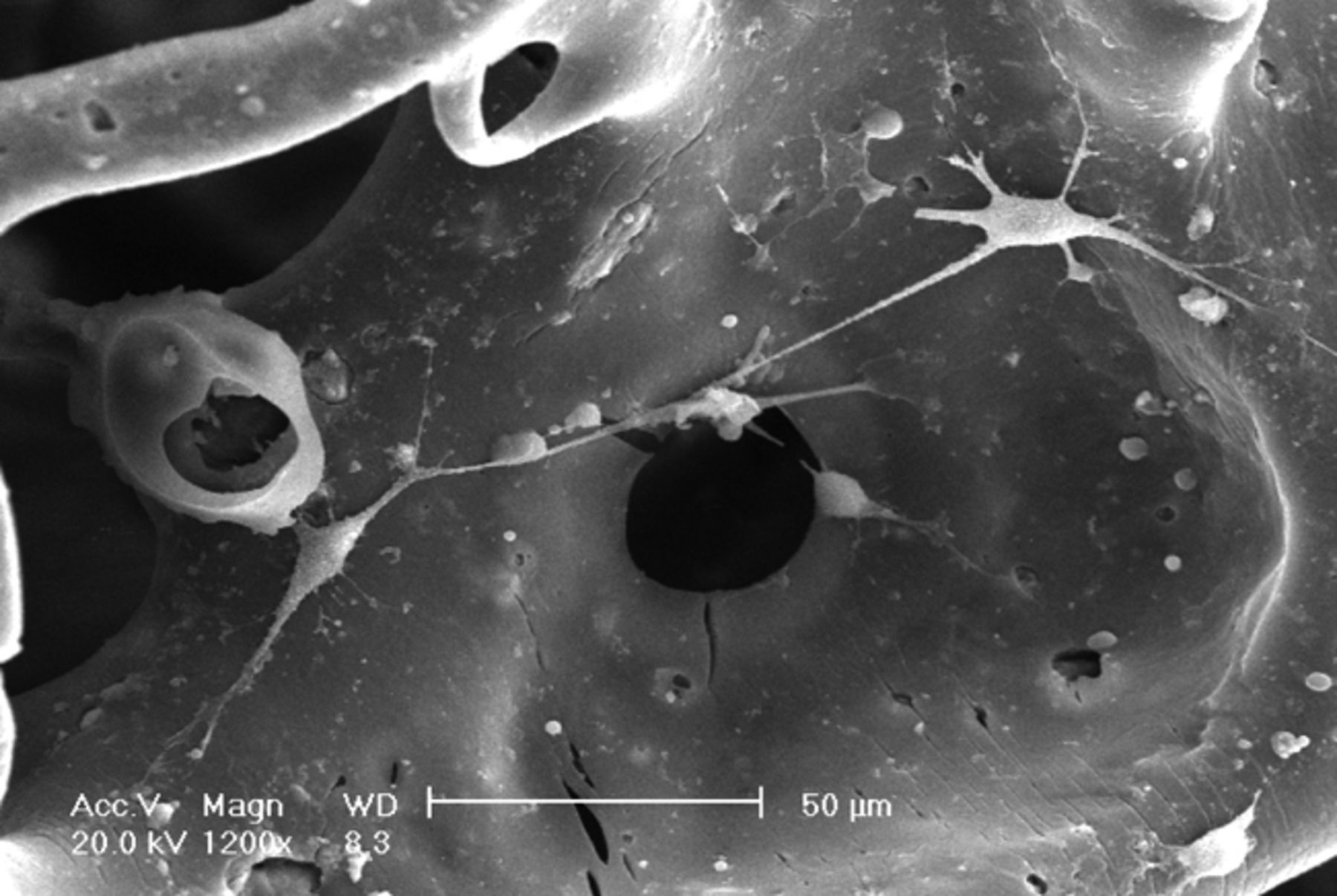 Figs. 2a - 2f 
          Scanning electron microscope
micrographs of bone marrow stromal cells cultured on the scaffold
showing a) the upper layer of the scaffold after one day in culture,
b) lower layer of the scaffold after one day in culture, c) upper
layer of the scaffold after three days of culture, d) lower layer
of the scaffold after three days of culture, e) upper layer of the
scaffold after seven days of culture and f) lower layer of the scaffold
after seven days of culture.
        