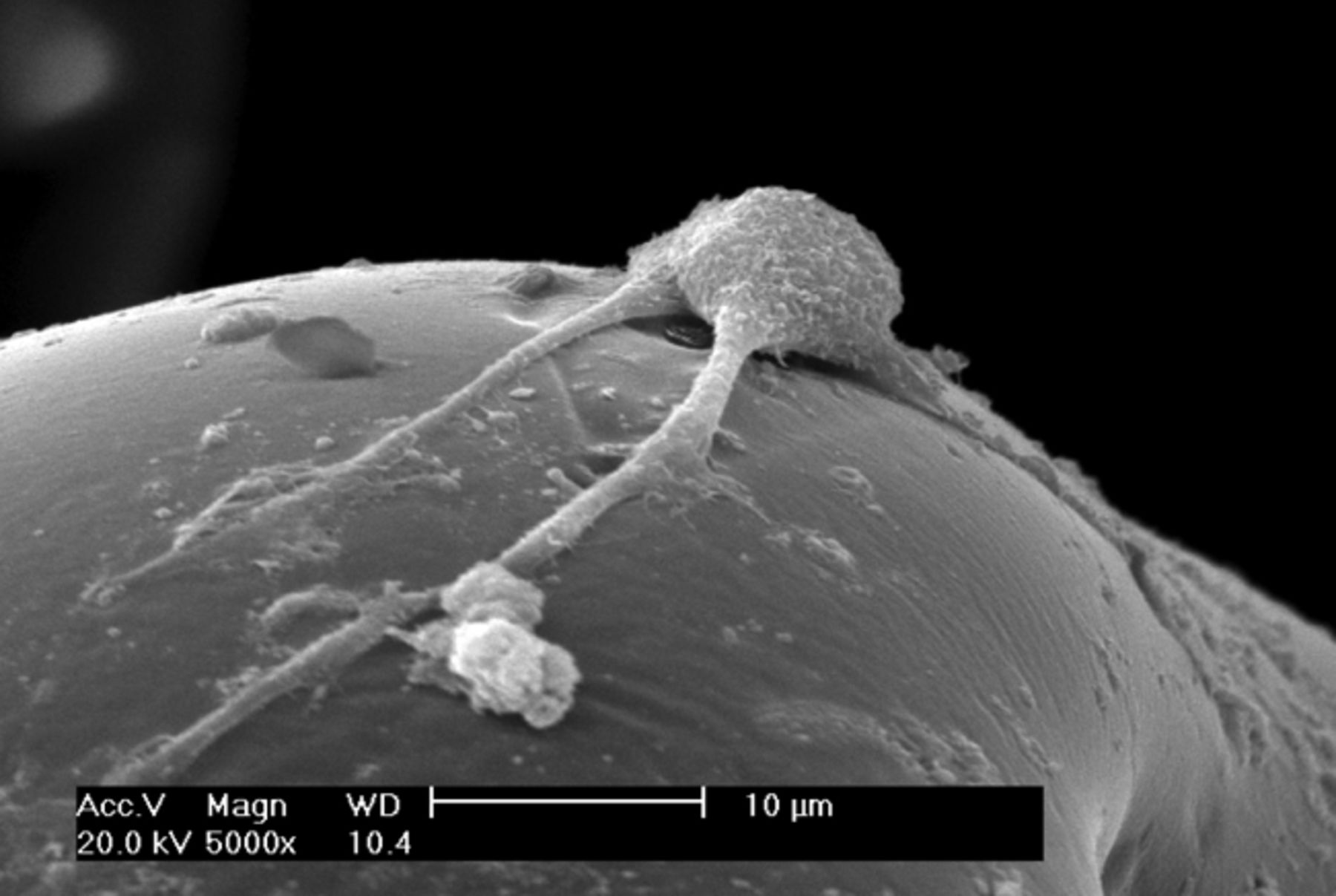 Figs. 2a - 2f 
          Scanning electron microscope
micrographs of bone marrow stromal cells cultured on the scaffold
showing a) the upper layer of the scaffold after one day in culture,
b) lower layer of the scaffold after one day in culture, c) upper
layer of the scaffold after three days of culture, d) lower layer
of the scaffold after three days of culture, e) upper layer of the
scaffold after seven days of culture and f) lower layer of the scaffold
after seven days of culture.
        