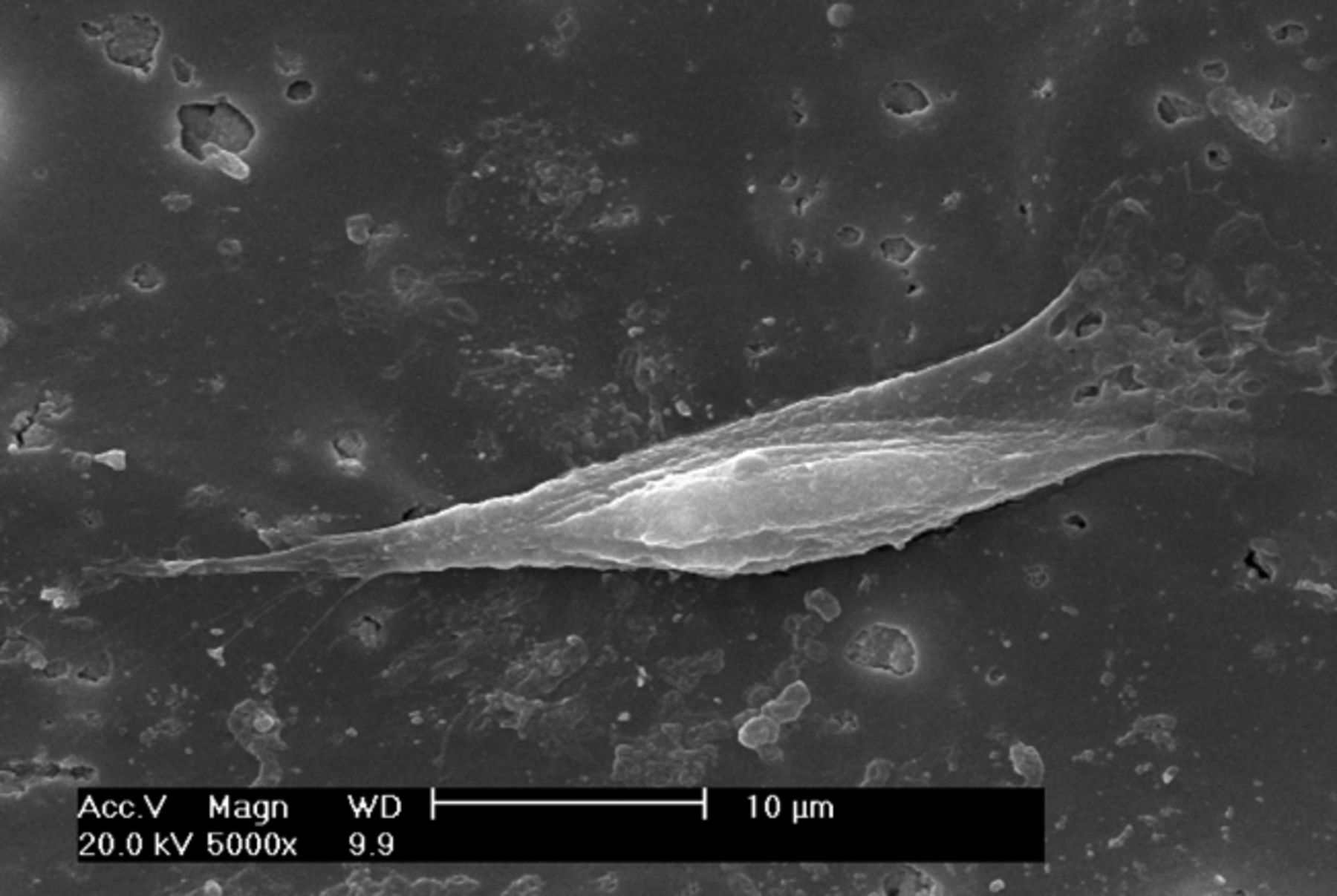 Figs. 2a - 2f 
          Scanning electron microscope
micrographs of bone marrow stromal cells cultured on the scaffold
showing a) the upper layer of the scaffold after one day in culture,
b) lower layer of the scaffold after one day in culture, c) upper
layer of the scaffold after three days of culture, d) lower layer
of the scaffold after three days of culture, e) upper layer of the
scaffold after seven days of culture and f) lower layer of the scaffold
after seven days of culture.
        